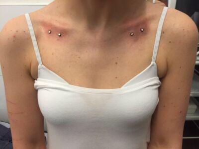 Dermal Piercings by Underground Tattoo and Piercing Studio in Watford
